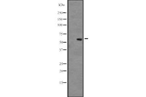 Western blot analysis of CLK3 expression in A431 whole cell lysate ,The lane on the left is treated with the antigen-specific peptide. (CLK3 抗体  (Internal Region))
