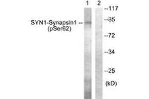 Western blot analysis of extracts from HeLa cells treated with Anisomycin 25ug/ml 30', using Synapsin1 (Phospho-Ser62) Antibody. (SYN1 抗体  (pSer62))