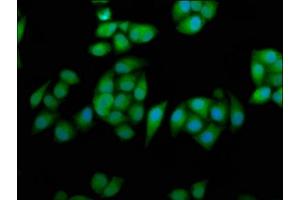 Immunofluorescence staining of Hela cells with ABIN7167824 at 1:233, counter-stained with DAPI. (RPE65 抗体  (AA 348-484))