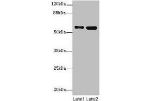 Western Blotting (WB) image for anti-Signal Transducing Adaptor Molecule (SH3 Domain and ITAM Motif) 2 (STAM2) (AA 376-525) antibody (ABIN7169694)