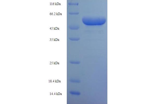 PRPS1 Protein (AA 2-318) (His-SUMO Tag)