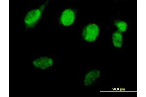 Immunofluorescence of purified MaxPab antibody to RAD51L3 on HeLa cell. (RAD51D 抗体  (AA 1-216))