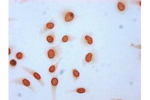 Immunocytochemistry analysis of ABIN7139150 diluted at 1:4 and staining in Hela cells (treated with 30mM sodium butyrate for 4h) performed on a Leica BondTM system. (HIST1H3A 抗体  (acLys115))