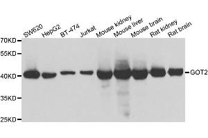 Western blot analysis of extracts of various cell lines, using GOT2 antibody. (GOT2 抗体)