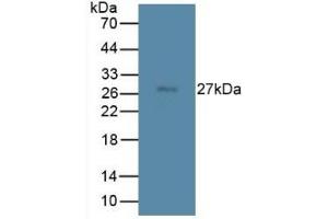 Detection of TMEM27 in Rat Spleen Tissue using Monoclonal Antibody to Transmembrane Protein 27 (TMEM27) (TMEM27 抗体  (AA 12-222))