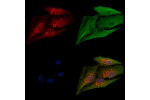 ABIN6264148 and ABIN6279651 staining  cells by IF/ICC.