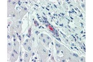Immunohistochemistry (Formalin/PFA-fixed paraffin-embedded sections) of human liver with SLC5A1 polyclonal antibody . (SLC5A1 抗体  (Internal Region))