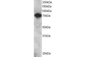 ABIN184884 staining (2µg/ml) of Daudi lysate (RIPA buffer, 30µg total protein per lane). (SETMAR 抗体  (C-Term))