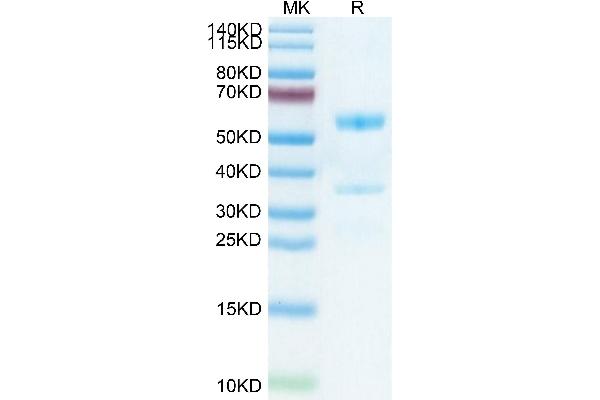 MFAP5 Protein (AA 29-164) (Fc Tag)