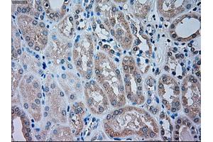 Immunohistochemistry (IHC) image for anti-Transient Receptor Potential Cation Channel, Subfamily M, Member 4 (TRPM4) antibody (ABIN2725815)
