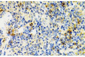 Immunohistochemistry of paraffin-embedded Mouse spleen using SH2B1 Polyclonal Antibody at dilution of 1:100 (40x lens). (SH2B1 抗体)