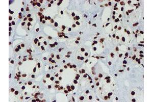 Immunohistochemical staining of paraffin-embedded Human Kidney tissue using anti-NONO mouse monoclonal antibody. (NONO 抗体  (AA 184-385))