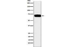 Western blot analysis of Poliovirus Receptor expression in U87-MG cell lysate. (Recombinant Poliovirus Receptor 抗体)