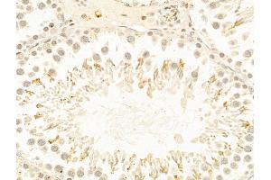 ABIN7094241 and ABIN7098288 at 1/100 staining Rat testis tissue by IHC-P.