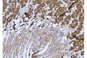 ABIN6277536 at 1/100 staining Human gastric tissue by IHC-P. (LTBR 抗体  (N-Term))