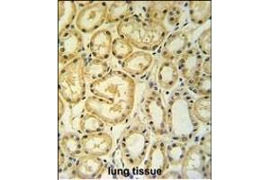 RT25 Antibody (C-term) (ABIN653808 and ABIN2843083) IHC analysis in formalin fixed and paraffin embedded human lung tissue followed by peroxidase conjugation of the secondary antibody and DAB staining. (MRPS25 抗体  (C-Term))