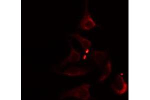 ABIN6274804 staining Hela cells by IF/ICC. (ACOT1 抗体  (Internal Region))