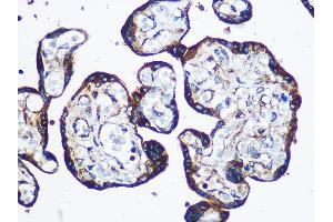 Immunohistochemistry (IHC) image for anti-YTH Domain Family, Member 2 (YTHDF2) (AA 1-200) antibody (ABIN7271427)