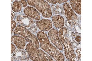 ABIN6266504 at 1/200 staining human kidney tissue sections by IHC-P. (JUP 抗体  (C-Term))