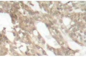 Immunohistochemistry (IHC) analyzes of PKC theta antibody in paraffin-embedded human skeletal muscle tissue. (PKC theta 抗体)