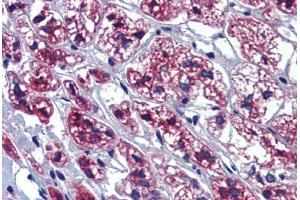 Human Adrenal (formalin-fixed, paraffin-embedded) stained with GTPBP10 antibody ABIN462237 followed by biotinylated goat anti-rabbit IgG secondary antibody ABIN481713, alkaline phosphatase-streptavidin and chromogen. (GTPBP10 抗体  (AA 254-303))