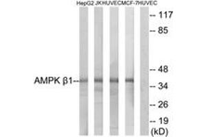 Western blot analysis of extracts from HepG2/Jurkat/HuvEc/MCF-7 cells, using AMPK beta1 (Ab-181) Antibody. (PRKAB1 抗体  (AA 147-196))