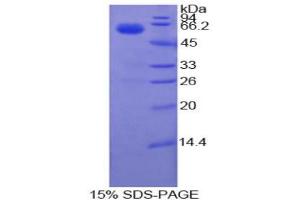 SDS-PAGE analysis of Cow Coagulation Factor VII Protein. (Factor VII 蛋白)