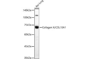 Western blot analysis of extracts of Rat lung, using Collagen X/COL10 antibody (8604) at 1:500 dilution. (COL10A1 抗体)