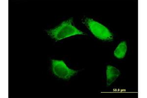Immunofluorescence of purified MaxPab antibody to URP2 on HeLa cell. (FERMT3 抗体  (AA 1-663))