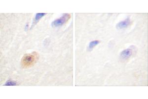 Peptide - +Immunohistochemical analysis of paraffin-embedded human brain tissue using CSantibody. (Exportin 2 抗体)