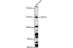Western blot analysis of extracts of Rat brain, using ZNF521 antibody (ABIN7271496) at 1:1000 dilution. (ZNF521 抗体  (AA 210-420))