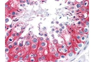 Immunohistochemistry (IHC) image for anti-Stromal Interaction Molecule 1 (STIM1) (AA 24-686) antibody (ABIN614666) (STIM1 抗体  (AA 24-686))