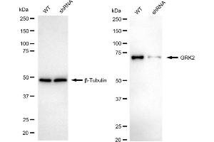Western blotting analysis using GRK2 antibody (ABIN7797538).