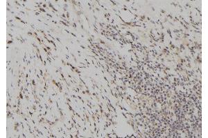 Immunohistochemistry (IHC) image for anti-Cystatin A (Stefin A) (CSTA) (C-Term) antibody (ABIN6261071)
