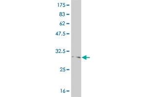 Western Blot detection against Immunogen (37. (FOXL1 抗体  (AA 132-240))