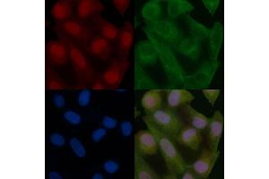 DNA polymerase delta p50 Mouse Monoclonal Antibody staining Hela cells by IF/ICC. (POLD2 抗体)