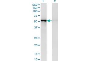 Western Blot analysis of ZNF207 expression in transfected 293T cell line by ZNF207 monoclonal antibody (M03), clone 6H8. (ZNF207 抗体  (AA 1-110))