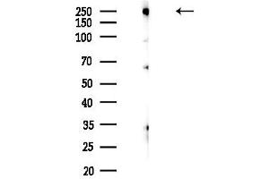 anti-Calcineurin Binding Protein 1 (CABIN1) (Internal Region) antibody