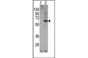 Western blot analysis of PRKAA2 (arrow) using rabbit polyclonal PRKAA2 Antibody (PRKAA2 抗体  (C-Term))