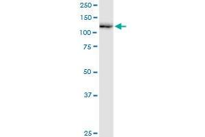 Western Blotting (WB) image for anti-Ring Finger Protein 20 (RNF20) (AA 1-975) antibody (ABIN1327712)