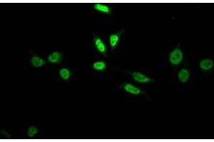 Immunofluorescence staining of HepG2 Cells with ABIN7127811 at 1:50, counter-stained with DAPI. (Recombinant SKP2 抗体)