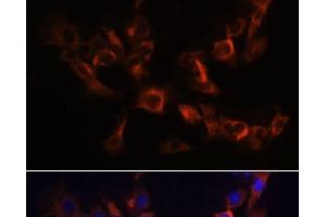 Immunofluorescence analysis of C6 cells using ARL13B Polyclonal Antibody at dilution of 1:100. (ARL13B 抗体)