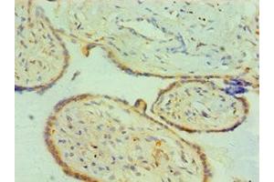 Immunohistochemistry of paraffin-embedded human placenta tissue using ABIN7147014 at dilution of 1:100 (Cathepsin K 抗体  (AA 115-329))
