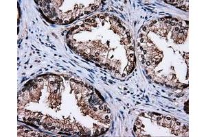 Immunohistochemical staining of paraffin-embedded liver tissue using anti-MCL1 mouse monoclonal antibody. (MCL-1 抗体)