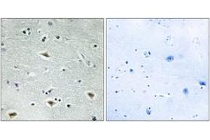 Immunohistochemistry analysis of paraffin-embedded human brain tissue, using MTG16 Antibody. (CBFA2T3 抗体  (AA 261-310))