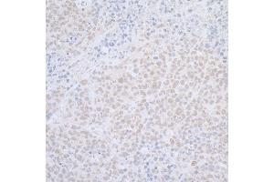 Immunohistochemistry (IHC) image for anti-ElaC Homolog 2 (ELAC2) (AA 776-826) antibody (ABIN7455054)
