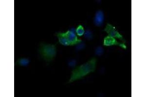Image no. 2 for anti-Mitogen-Activated Protein Kinase Kinase 1 (MAP2K1) antibody (ABIN1499374) (MEK1 抗体)
