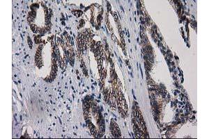 Image no. 1 for anti-Aminoacylase 3 (ACY3) antibody (ABIN1496462) (Aminoacylase 3 抗体)