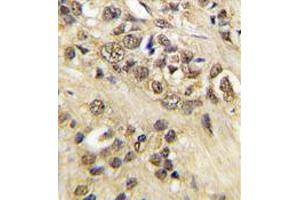 Image no. 2 for anti-Myc Proto-Oncogene protein (MYC) antibody (ABIN357365) (c-MYC 抗体)