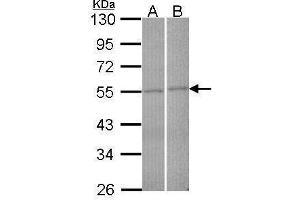 WB Image Sample (30 ug of whole cell lysate) A: Hela B: Raji 10% SDS PAGE antibody diluted at 1:2000 (FBXL2 抗体  (N-Term))